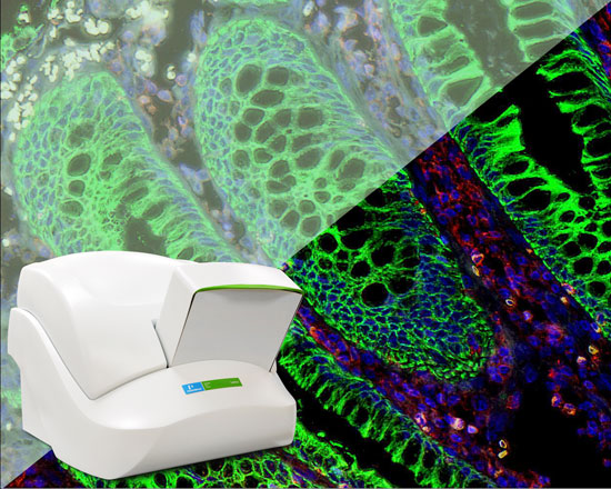 “As a leading provider of imaging platforms for disease research, PerkinElmer routinely engages research pathologists globally so we can better understand the complexities of studying disease markers and develop innovative solutions to meet their needs”