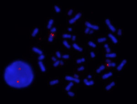 Customer input drives expansion of OGT’s Cytocell Aquarius® Haematology FISH probe range